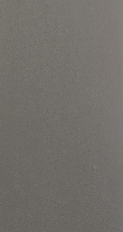 앞니 틀어짐 교정 조화롭게 마무리하려면 관련 이미지 33