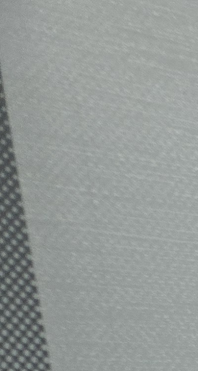 충치 검은점 나타났다면 이렇게 대처해요 관련 이미지 11