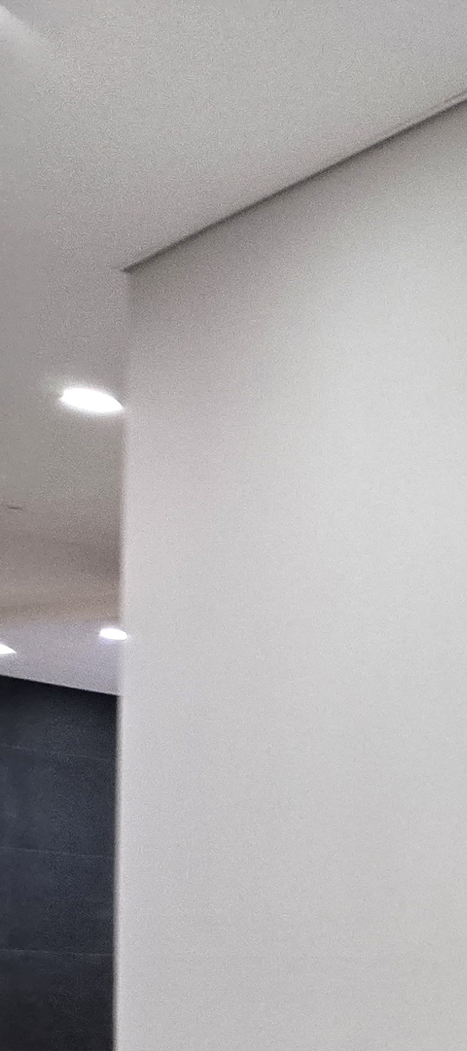 충치 치아 깨짐 시점이 관건이라면 관련 이미지 25