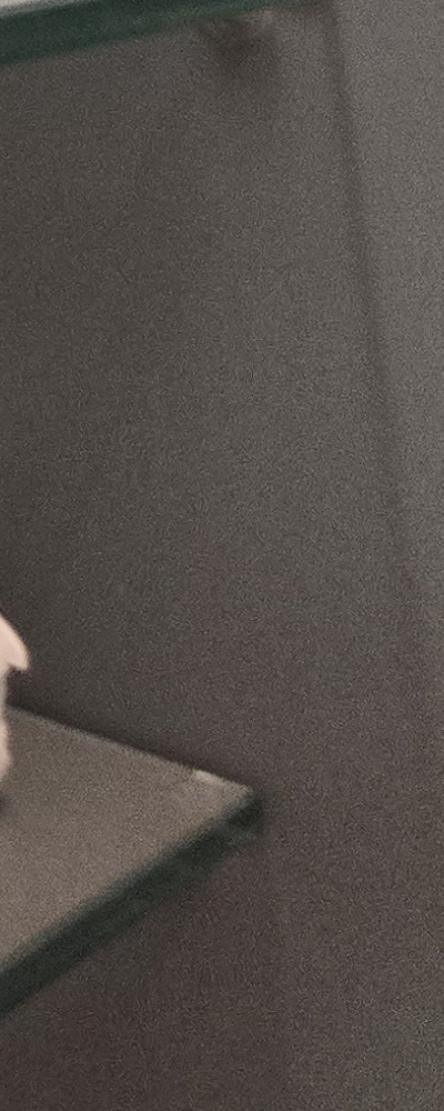 어르신 임플란트 지원 현명하게 활용하려면 관련 이미지 41