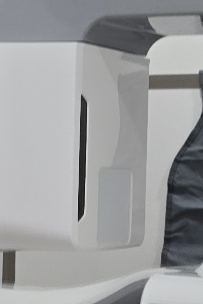 부정교합 교정 안하면 생기는 문제는 뭔가요 관련 이미지 34