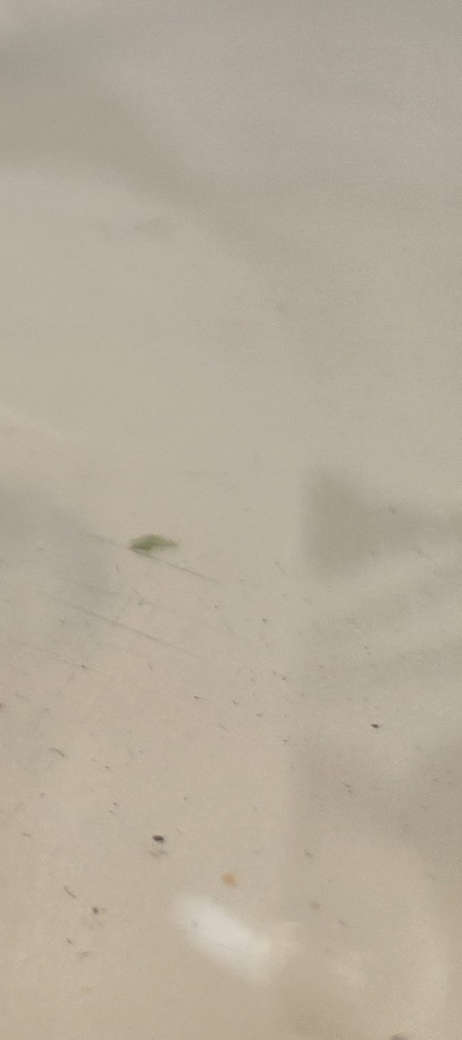 송곳니 덧니 발치 이럴때 해당되네요 관련 이미지 35