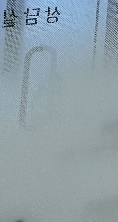 인레이 치료 후 통증 자꾸 심해지는데 괜찮은걸까 관련 이미지 43