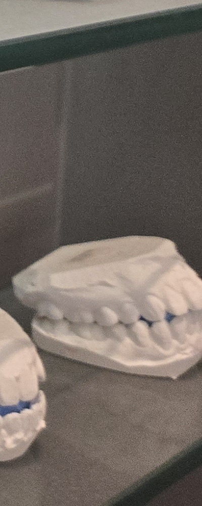 어르신 임플란트 지원 현명하게 활용하려면 관련 이미지 40