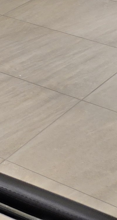 임플란트 뼈이식 안하면 어떤 문제가 있는거죠 관련 이미지 51