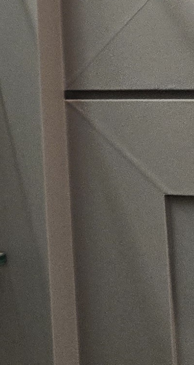 완전매복사랑니 발치 대학병원 꼭 가야하나요 관련 이미지 36