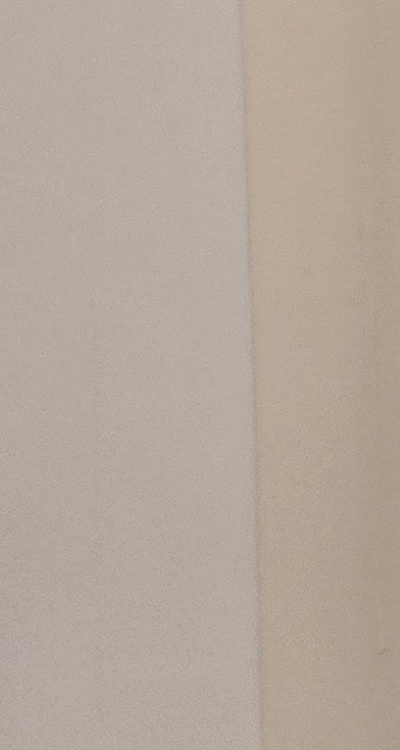 앞니 올세라믹 이건 알고 시작하세요 관련 이미지 31