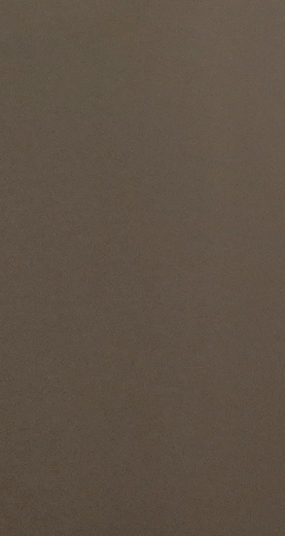 아말감 교체 레진 인레이 어떻게 대처하면 될까 관련 이미지 44