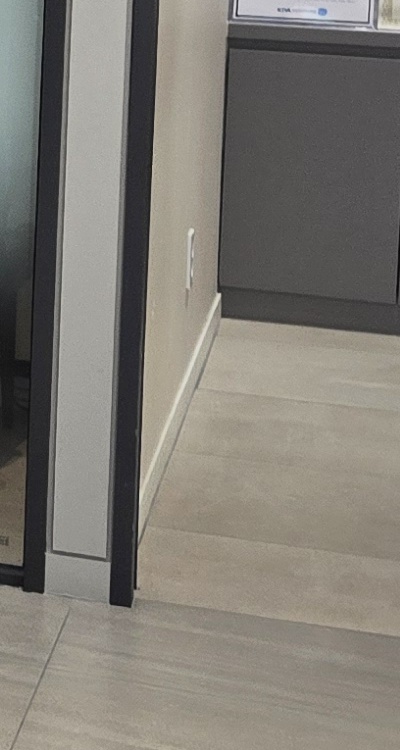 임플란트의 장점 할까 말까 고민이신 분들을 위한 정리 관련 이미지 38