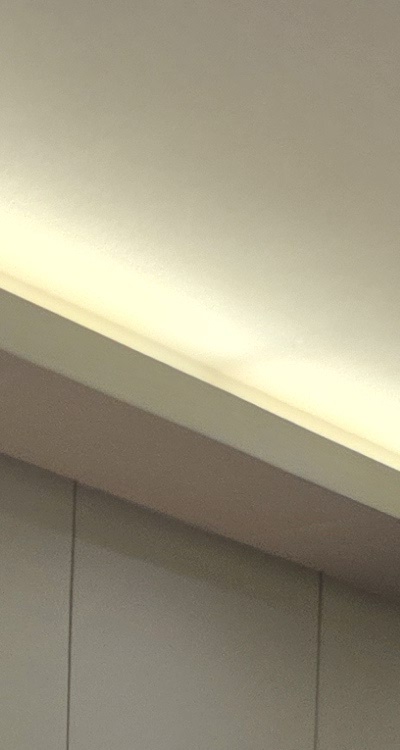 임플란트 뼈이식 안하면 어떤 문제가 있는거죠 관련 이미지 21