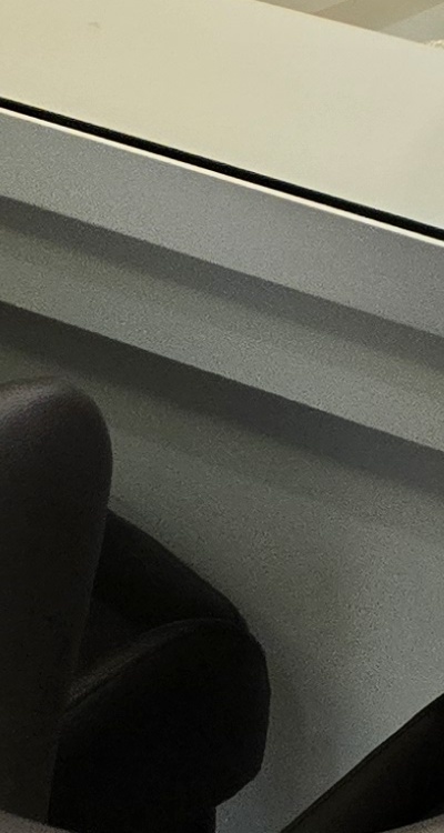 아래 사랑니 발치 통증 미리 알고 대처하려면 관련 이미지 41