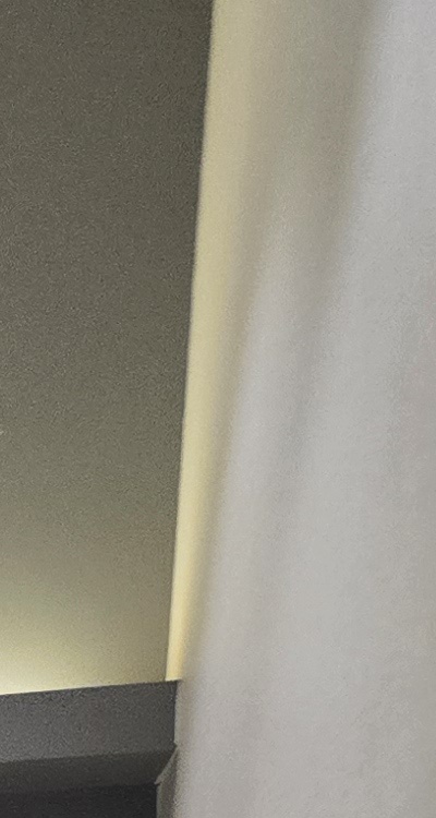 아래 사랑니 발치 통증 미리 알고 대처하려면 관련 이미지 18