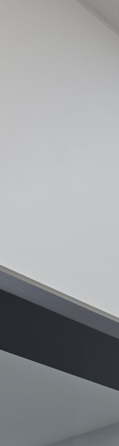 앞니 크라운 교체 깔끔하게 정리하려면 관련 이미지 15