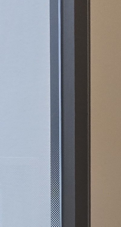 사랑니 발치 후 충치 치료 둘다 준비하려면 관련 이미지 25