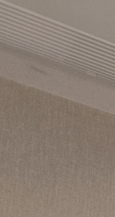 인레이 치료 후 통증 자꾸 심해지는데 괜찮은걸까 관련 이미지 13