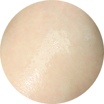 청소년여드름에좋은화장품 꿀피부는 사전예약중 관련 이미지 10