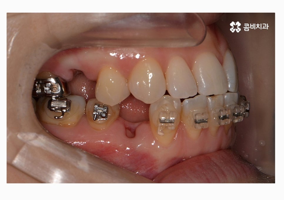 콤비교정 합리적으로 판단하려면 관련 이미지 9