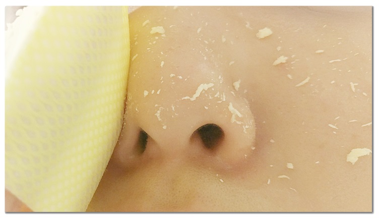 얼굴피지제거 제격이야! 관련 이미지 6