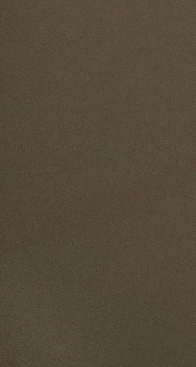 아말감 교체 레진 인레이 어떻게 대처하면 될까 관련 이미지 41