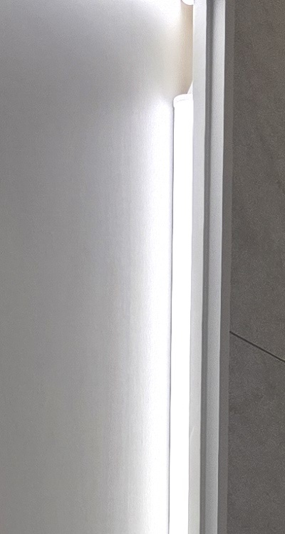 앞니 틀어짐 교정 조화롭게 마무리하려면 관련 이미지 14