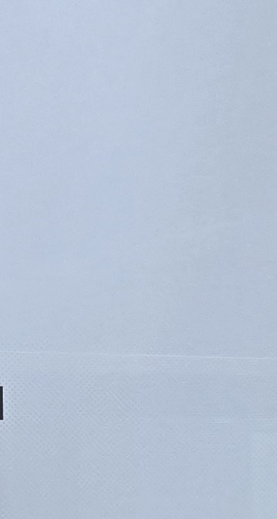 사랑니 발치 후 충치 치료 둘다 준비하려면 관련 이미지 24