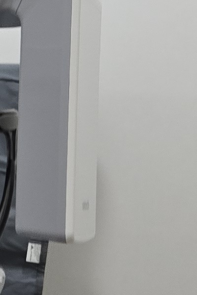 부정교합 교정 안하면 생기는 문제는 뭔가요 관련 이미지 36