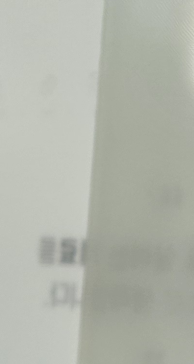 신경치료 아픈가요 망설이시는 분들이라면 관련 이미지 17