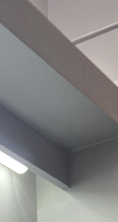 완전매복사랑니 발치 대학병원 꼭 가야하나요 관련 이미지 15