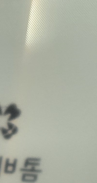 신경치료 아픈가요 망설이시는 분들이라면 관련 이미지 19