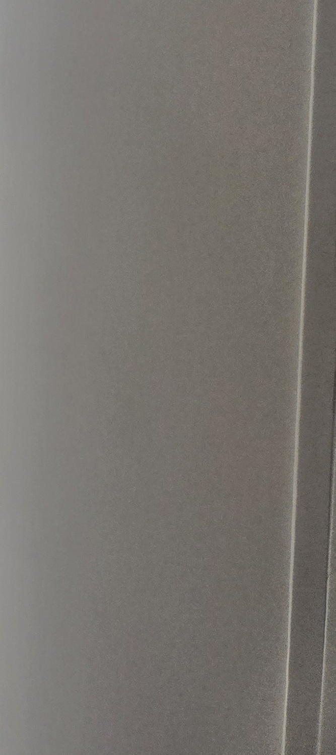 어금니 임플란트 통증 어렵게 느껴진다면 관련 이미지 27