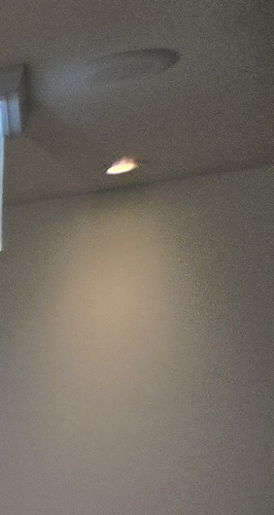 앞니 틀어짐 교정 조화롭게 마무리하려면 관련 이미지 18