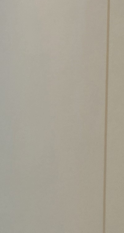 클리피씨교정 장단점 어떻게 비교하면 될까요 관련 이미지 27