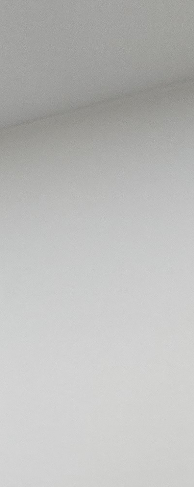 인레이 치료 후 신경치료 이유가 궁금하다면 관련 이미지 20