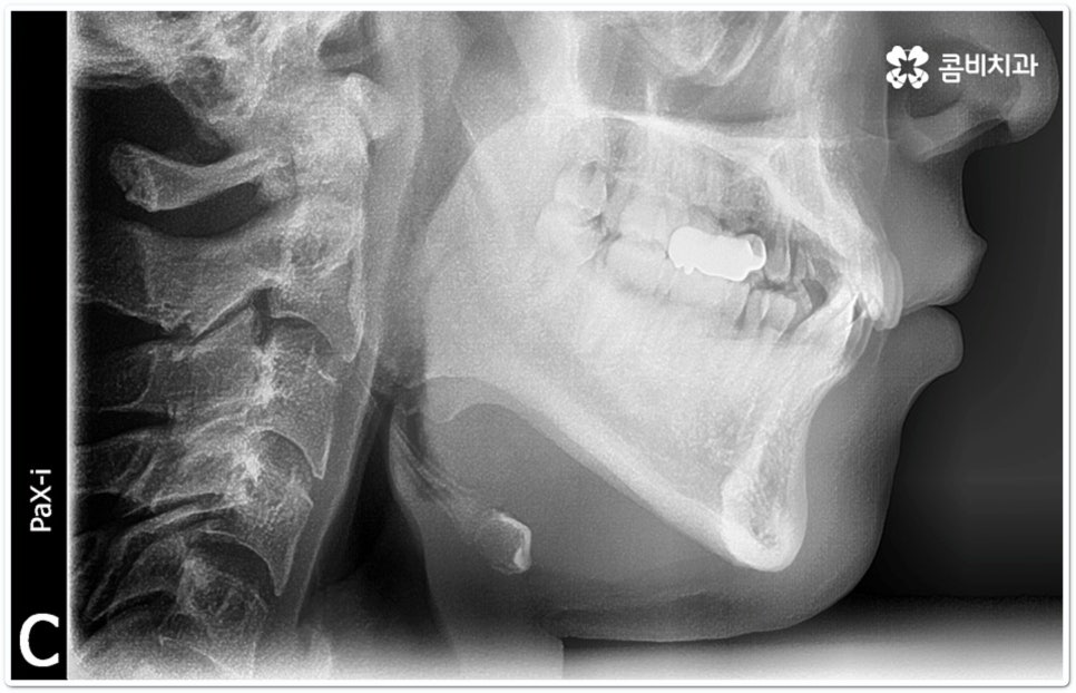 클리피씨교정 합리적인 초이스! 관련 이미지 1