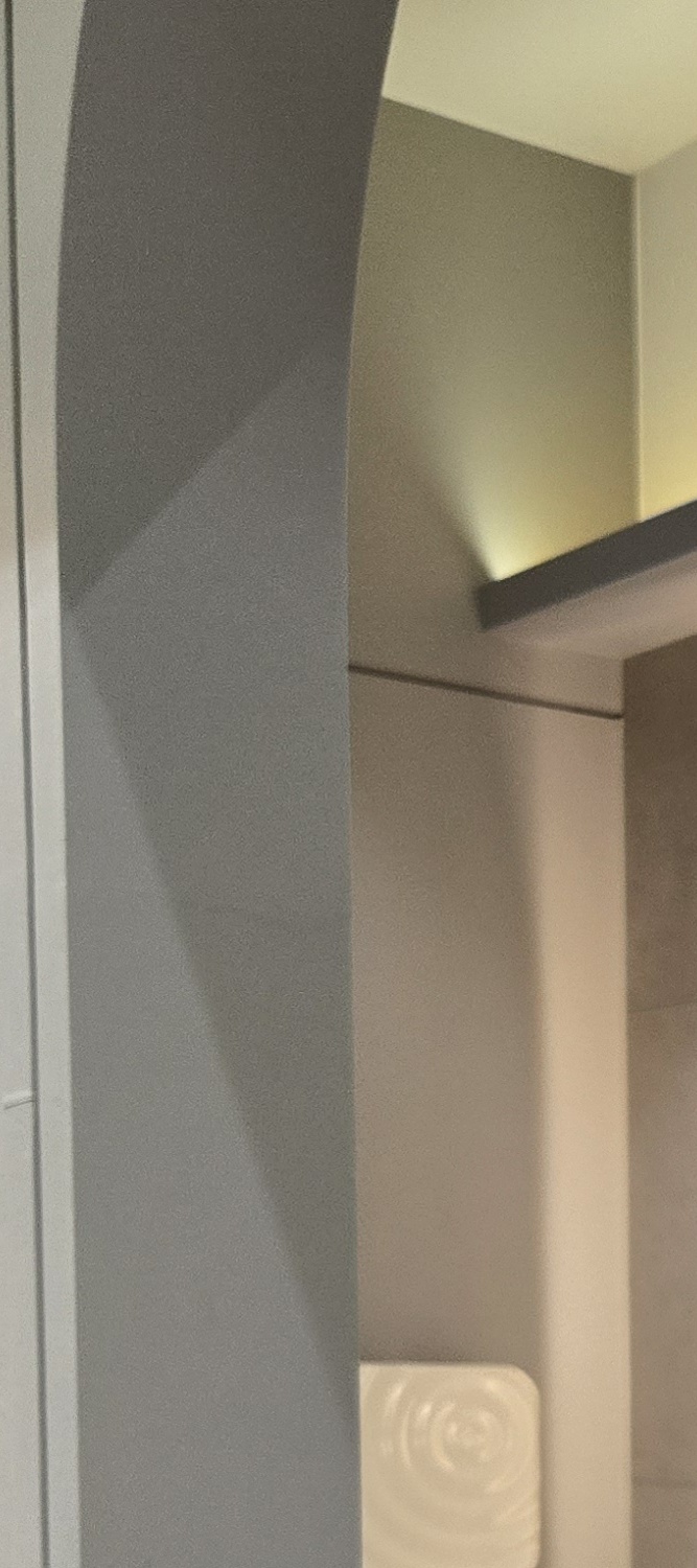 50대 임플란트 치과 지금부터 잘대처하려면 관련 이미지 26