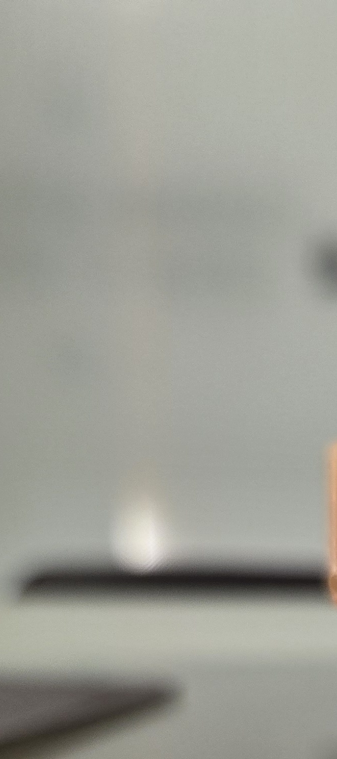 송곳니 덧니 발치 이럴때 해당되네요 관련 이미지 13