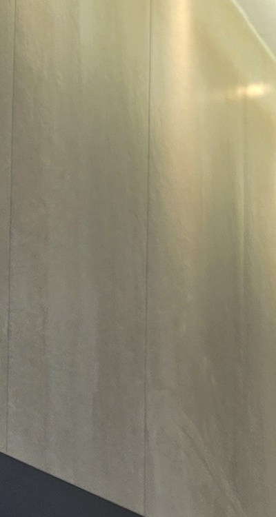 앞니 신경치료 크라운 까지 해야할 상황이라면 관련 이미지 28