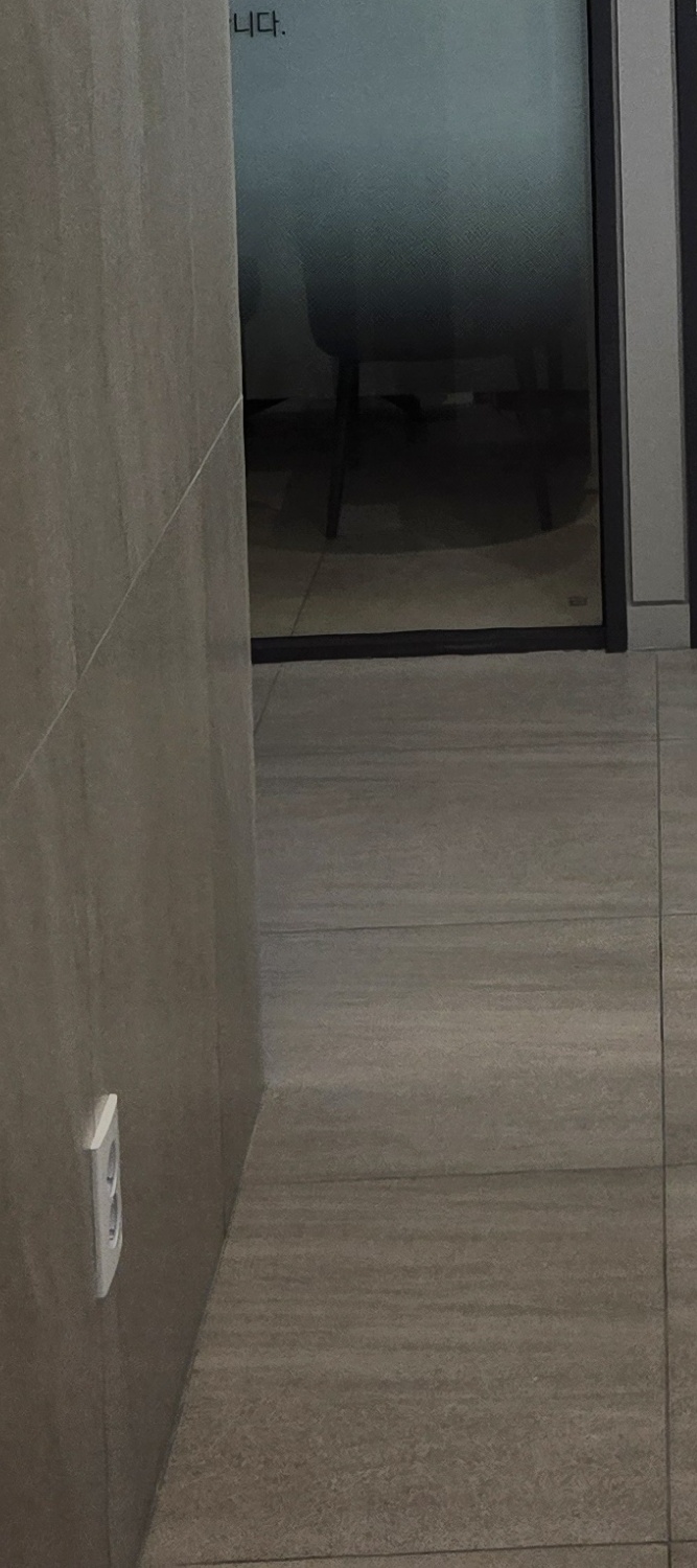 어금니 임플란트 통증 어렵게 느껴진다면 관련 이미지 24