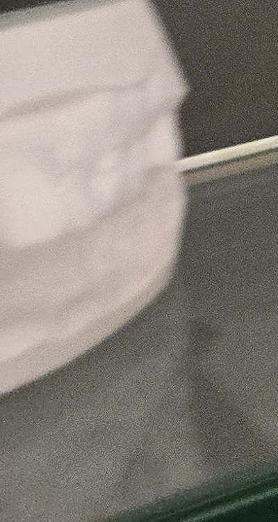 사랑니 주변 잇몸 통증 지금부터가 중요하니까 관련 이미지 42