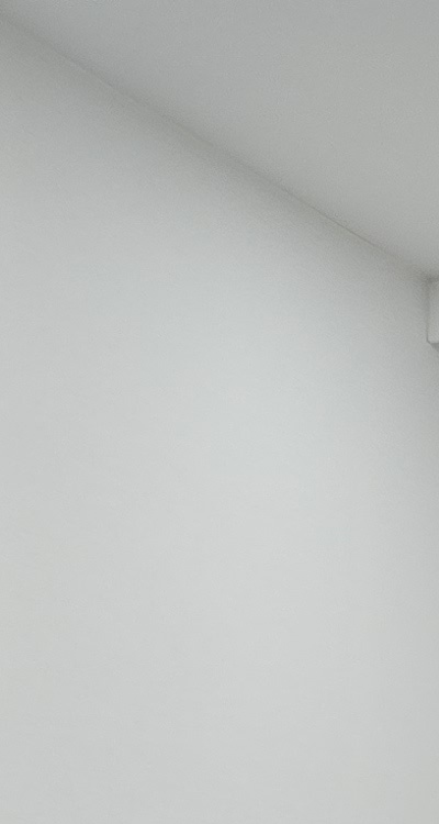 50대임플란트 꼼꼼하게 따져봐야할 포인트는 관련 이미지 16