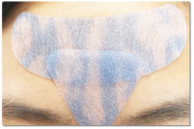 이마주름없애기 성공! 관련 이미지 5