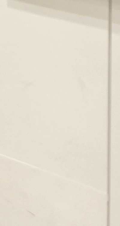 송곳니 크라운 티가 안나게 해결 가능한건가요 관련 이미지 33