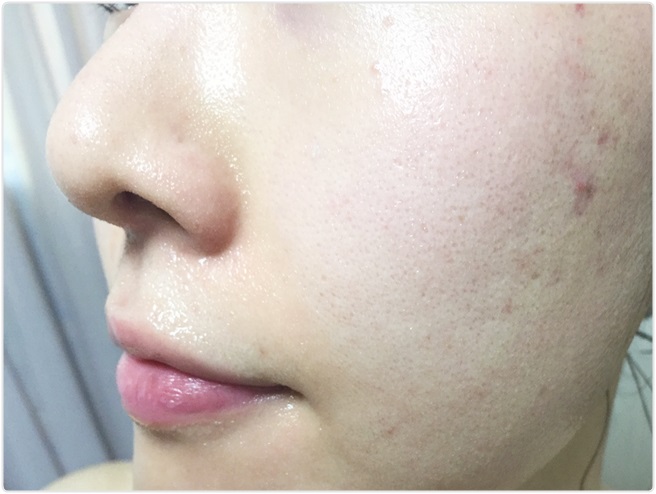 환절기 피부트러블 집에서 간편하게! 관련 이미지 10