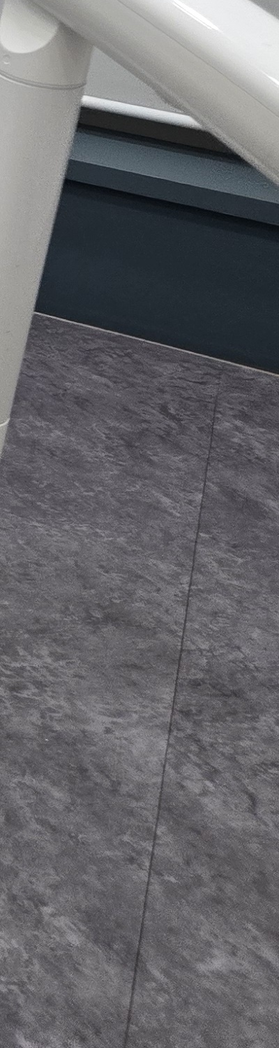 치과 치아미백 효과 어떤식으로 나타날까 관련 이미지 28