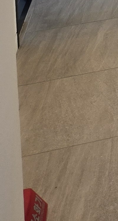 앞니 부분 교정 간단하니까 좋은건가요 관련 이미지 44