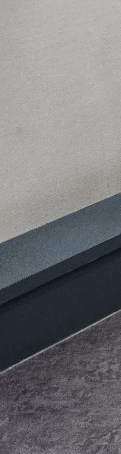 치과 치아미백 효과 어떤식으로 나타날까 관련 이미지 20