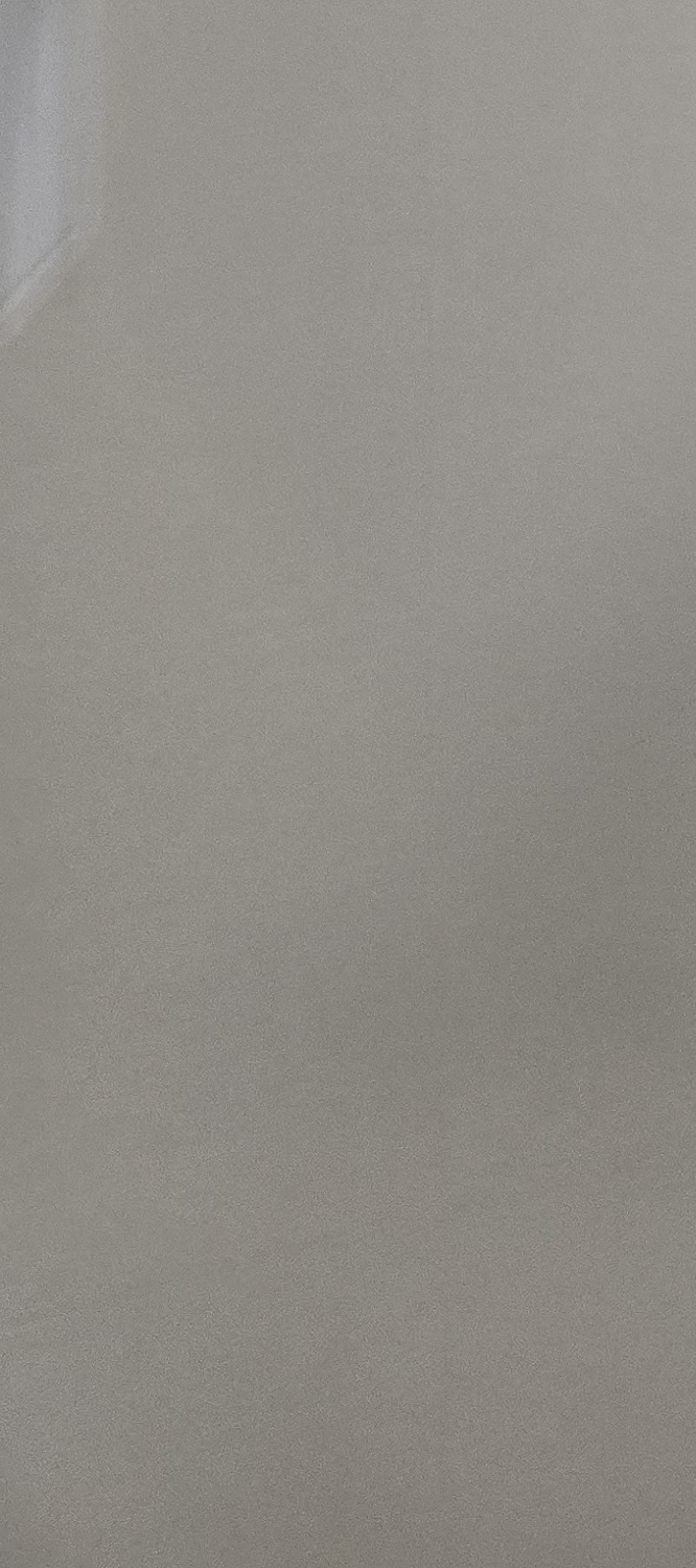 앞니 틀어짐 교정 이렇게 파악하세요 관련 이미지 28