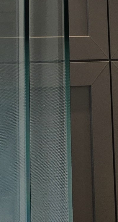 반대교합 치아교정 해결 가능할까 관련 이미지 43