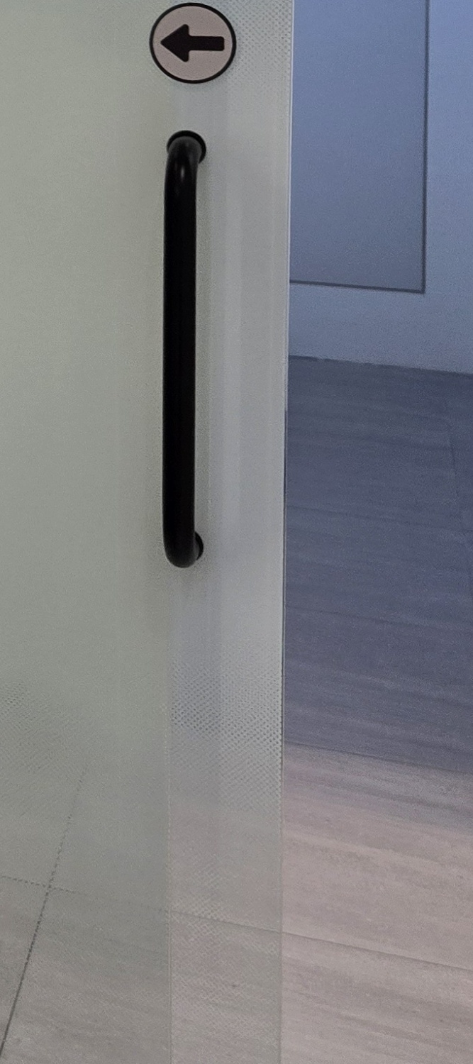 벌어진 앞니 교정 체계적으로 대비하려면 관련 이미지 22