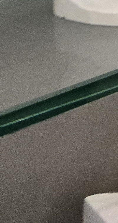 사랑니 주변 잇몸 통증 지금부터가 중요하니까 관련 이미지 45